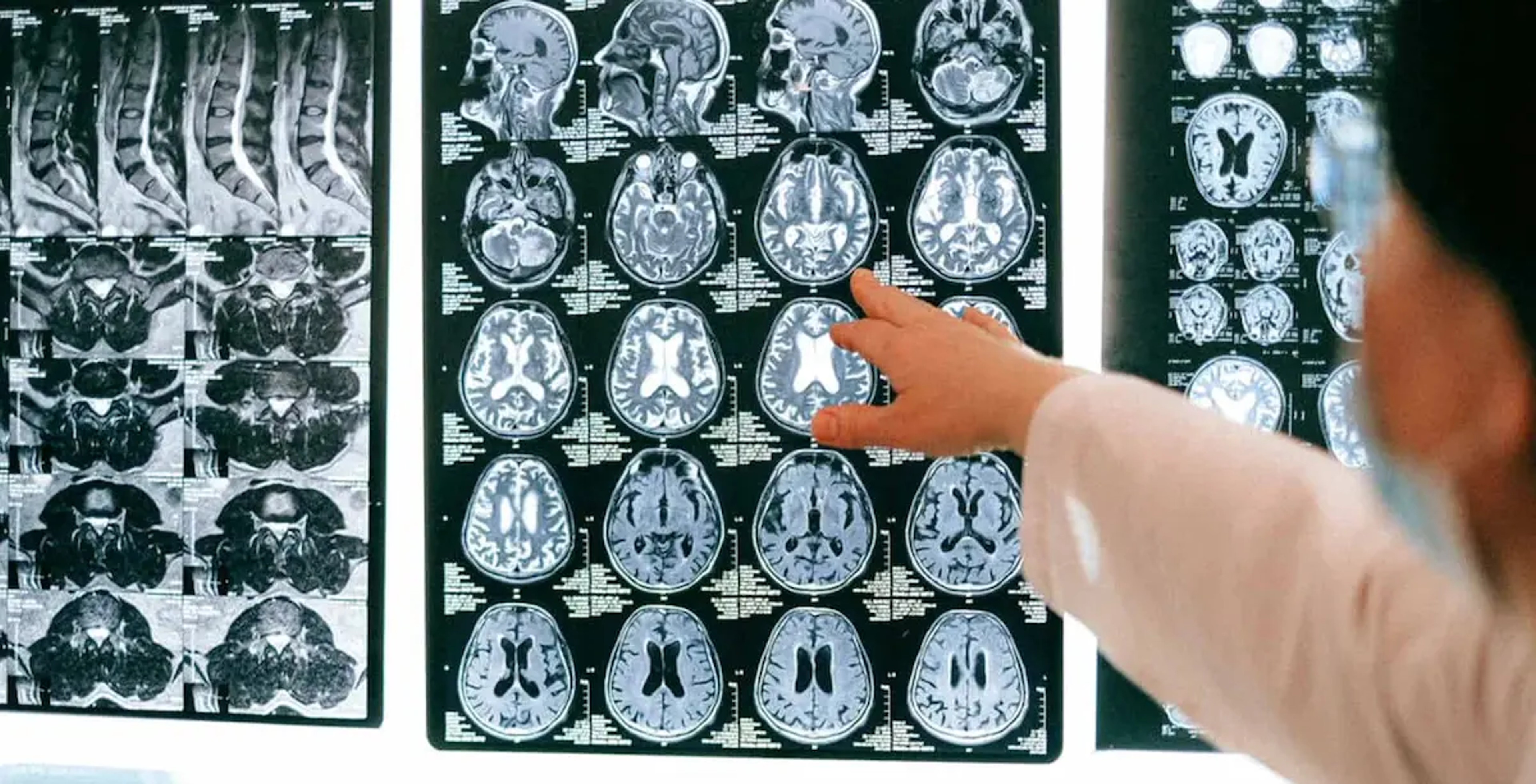 brain scan with ai intelligence