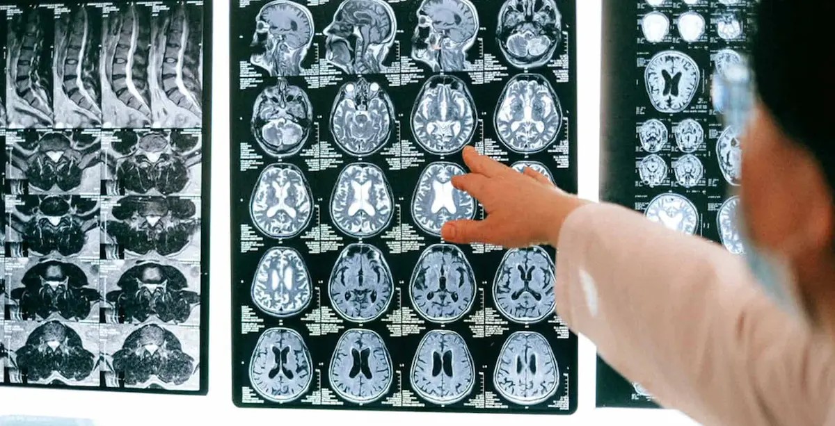 brain scan with ai intelligence