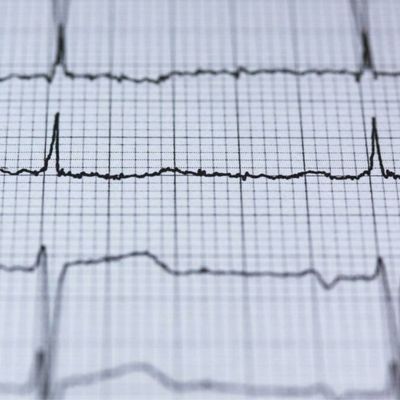 zoomed in ekg transcription