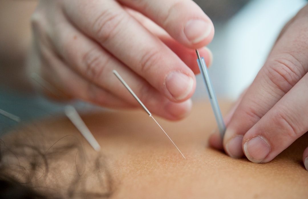 Planetary Acupuncture: Treating Earth as a Living Organism — holistic health
