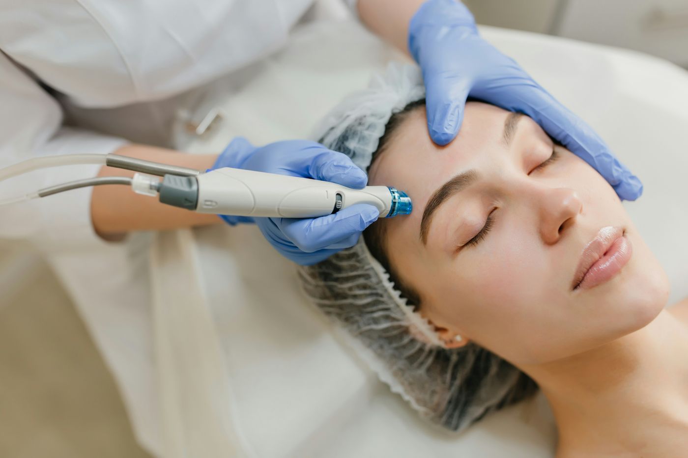 Rejuvenecimiento facial