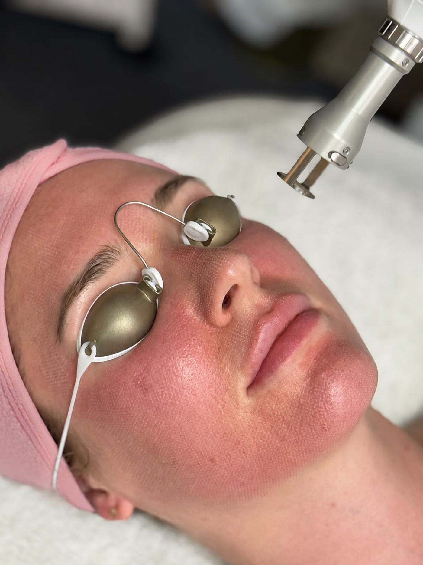 Rejuvenecimiento facial