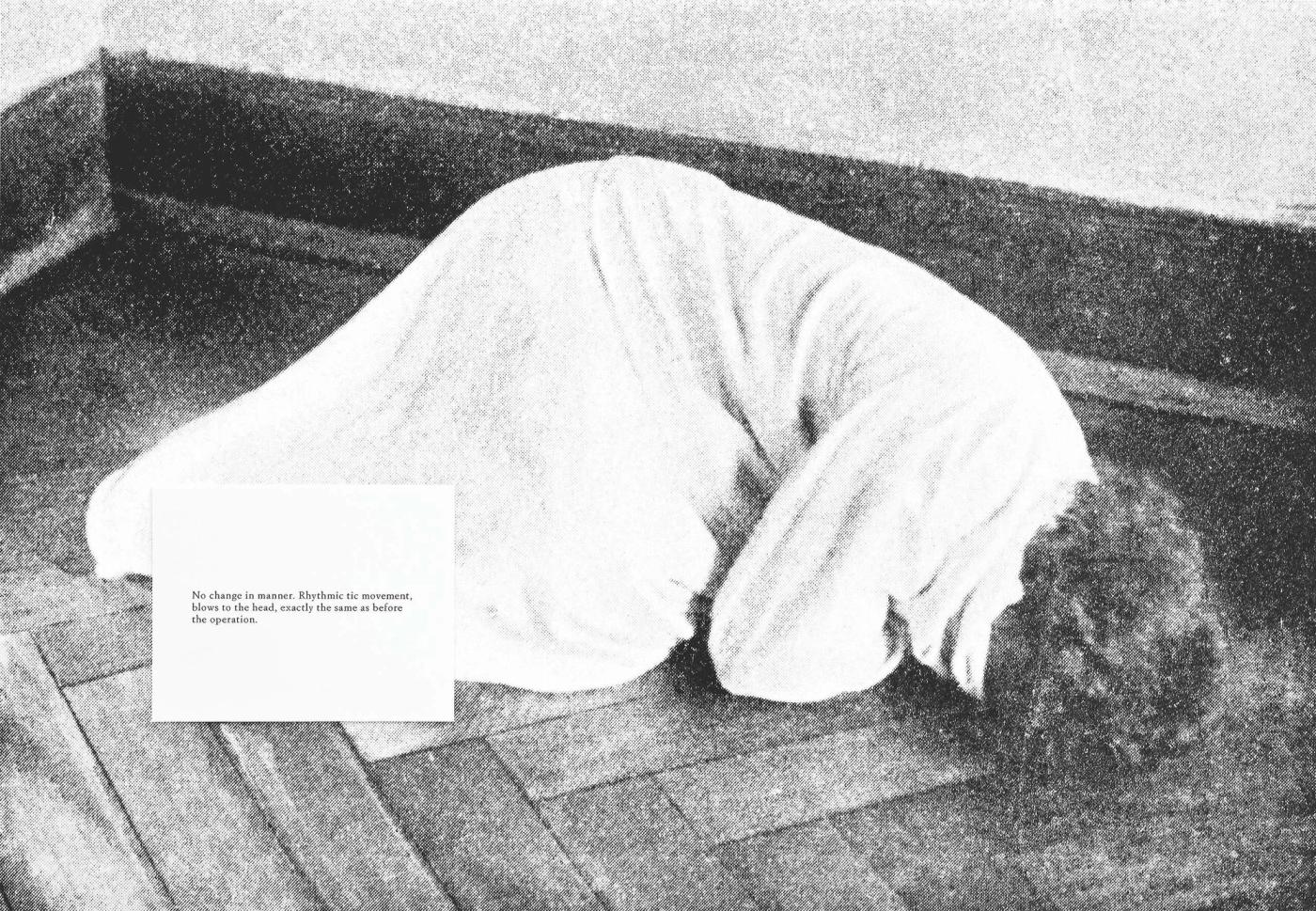 Milja Laurila. "Atlas und Grundriss der Psychiatrie (Blows to the head)", 2013. Archival pigment print, Diasec. 60 x 90 cm. © the artist. Courtesy: Persons Projects.