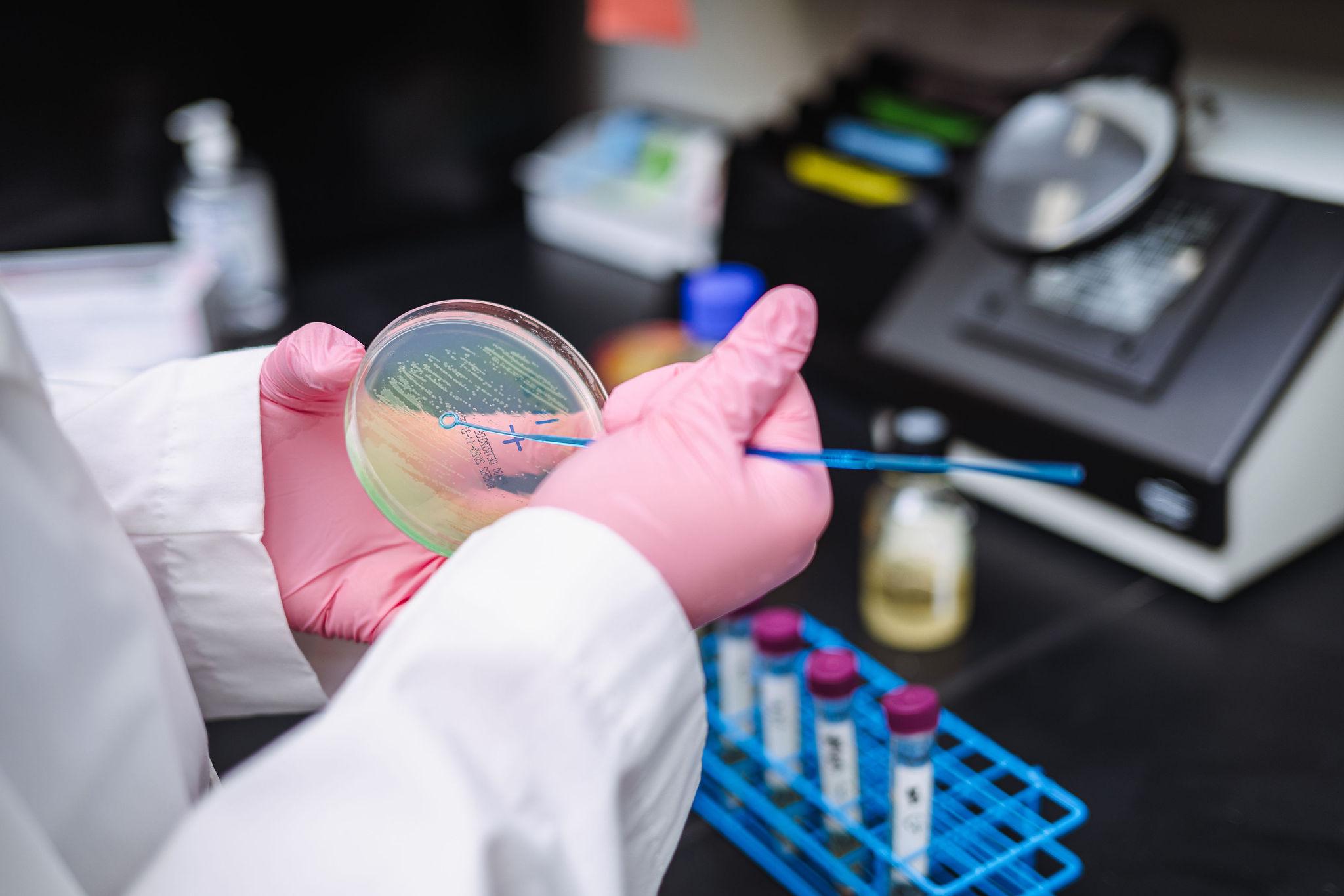 Petri dish culture analysis in WSI lab