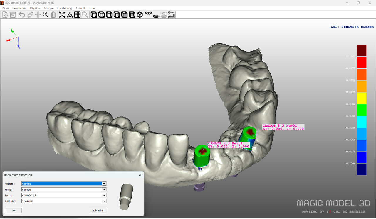 Magic Model 3D / Add On / Implantatmodul