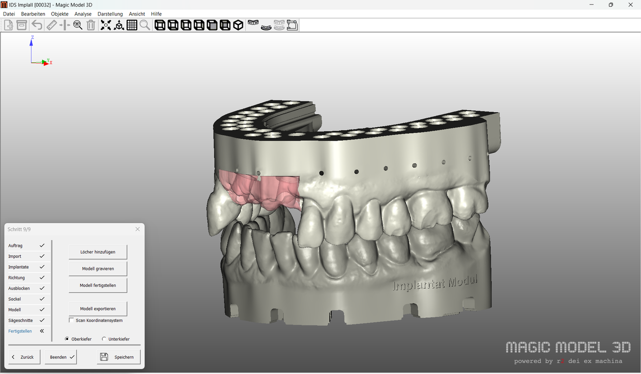 Magic Model 3D / Add On / Implantatmodul