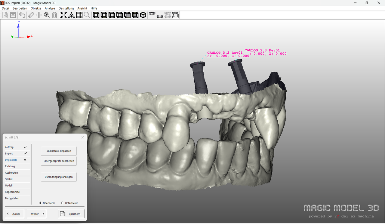 Magic Model 3D / Add On / Implantatmodul