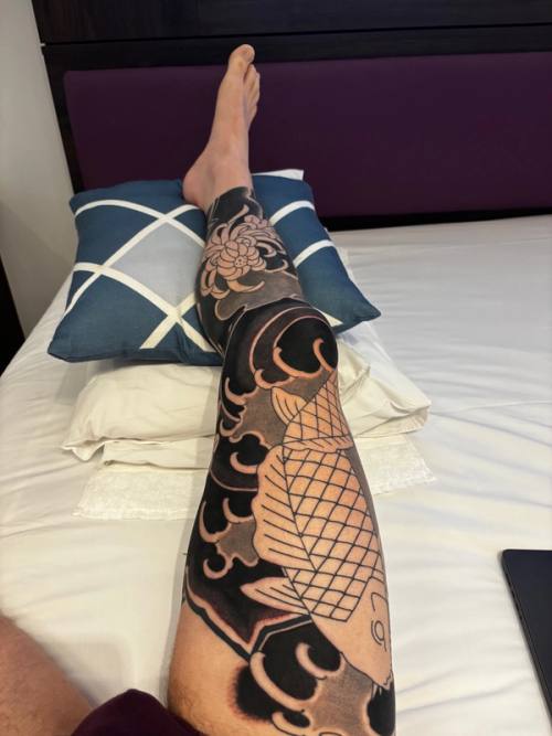 Right leg elevated on the hotel bed after day one, knee and inner thigh freshly shaded