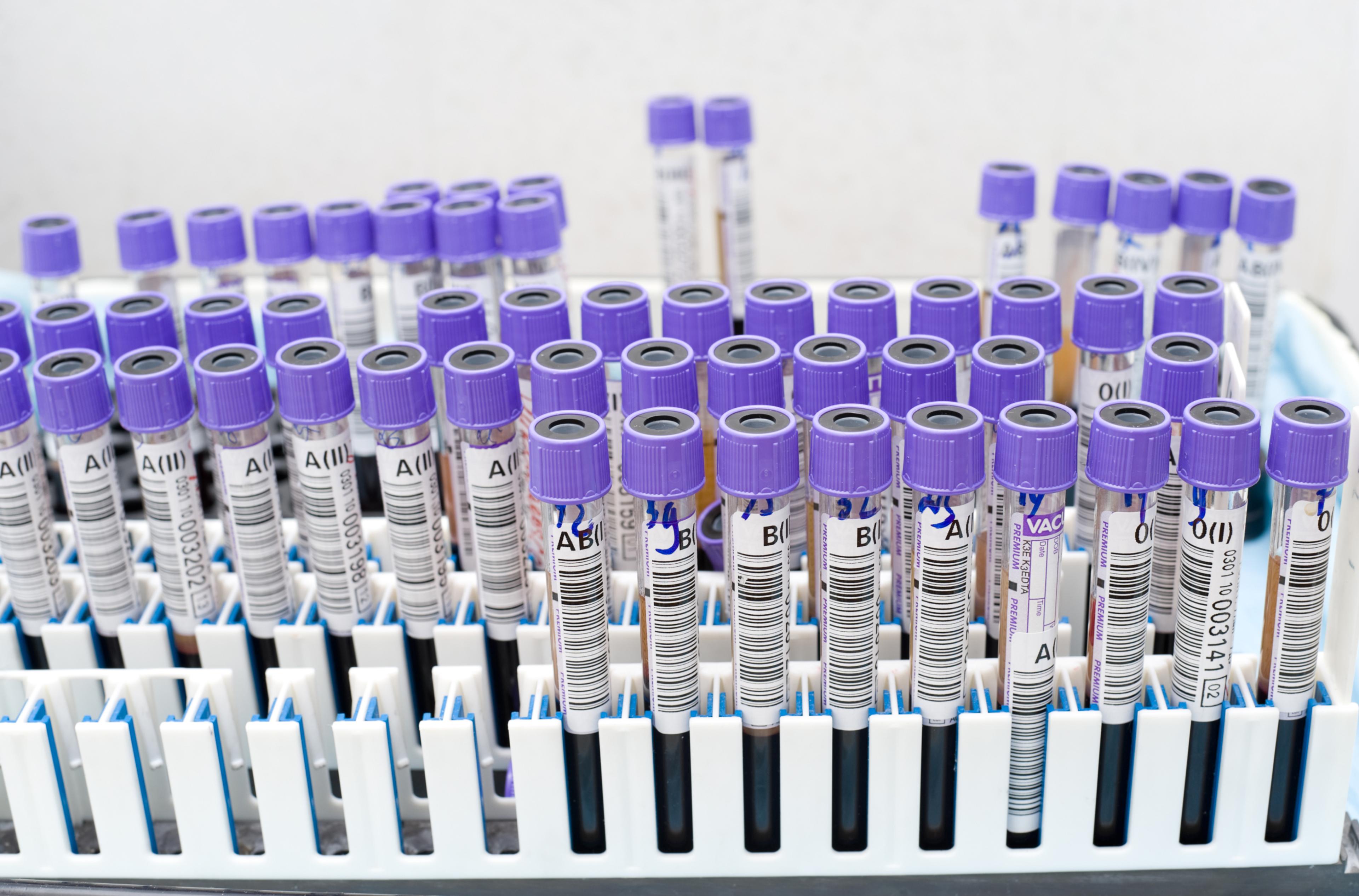 Rack of barcoded tubes