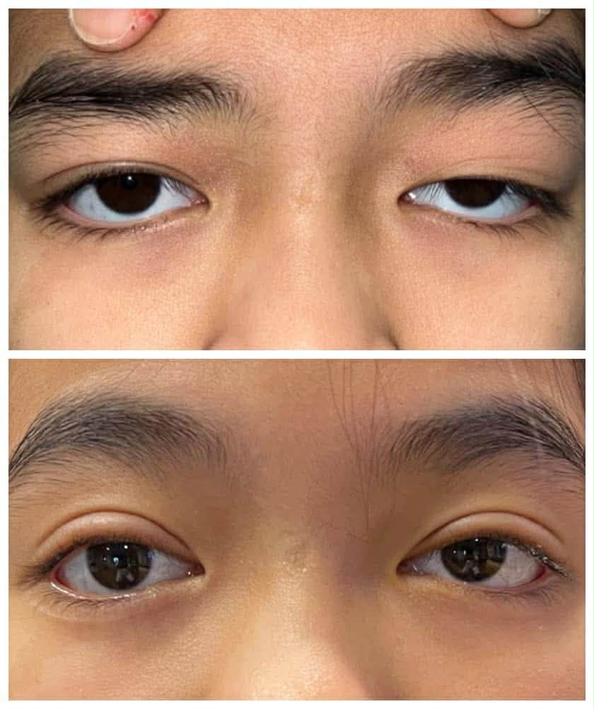 Before - after 5