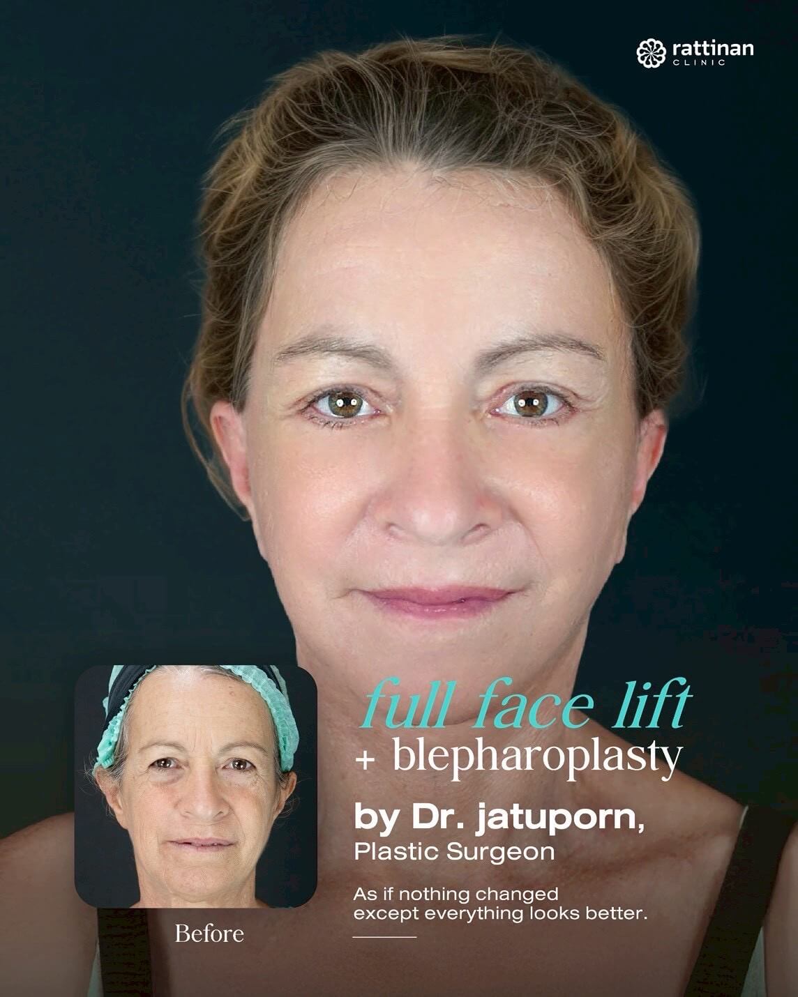 Before - after 1