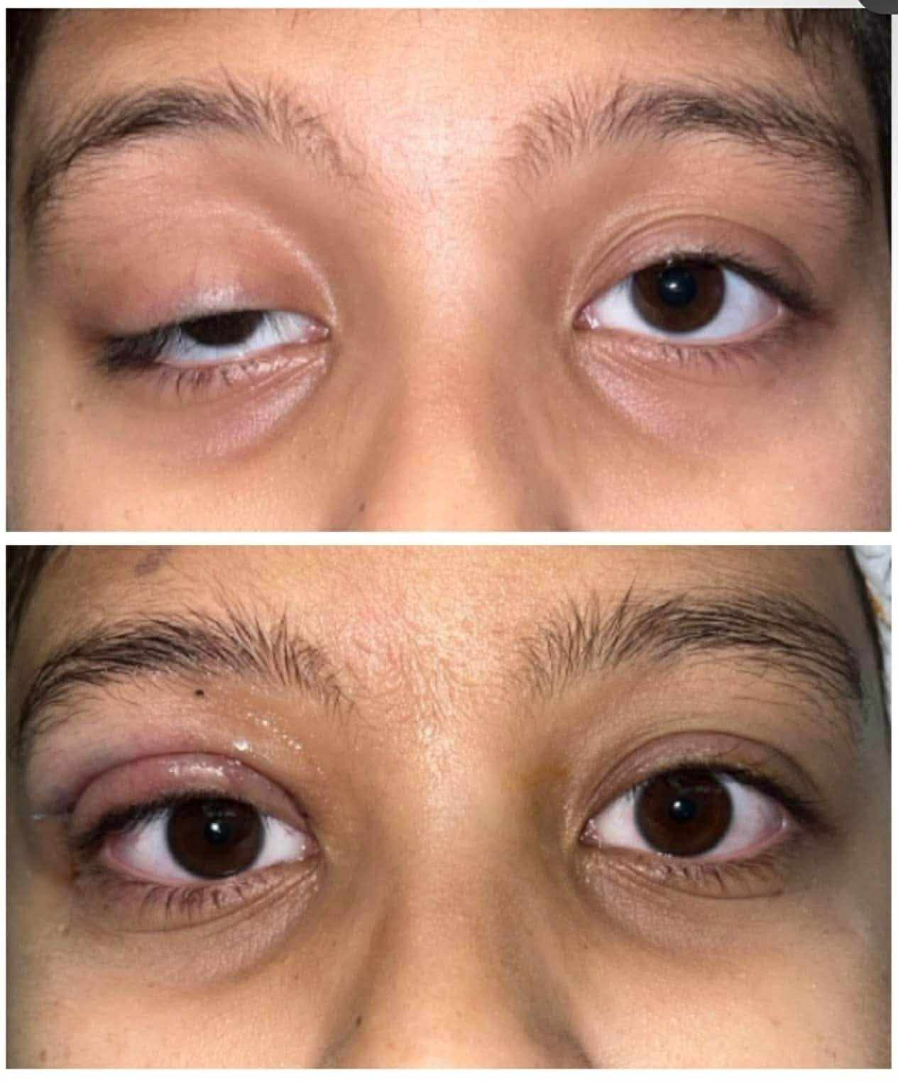 Before - after 3