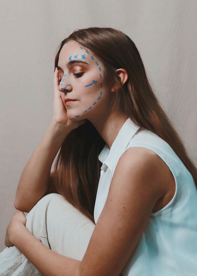 Facial feminization surgery 