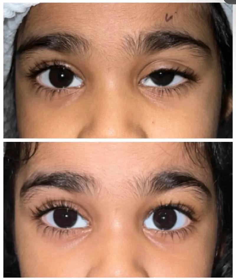 Before - after 1