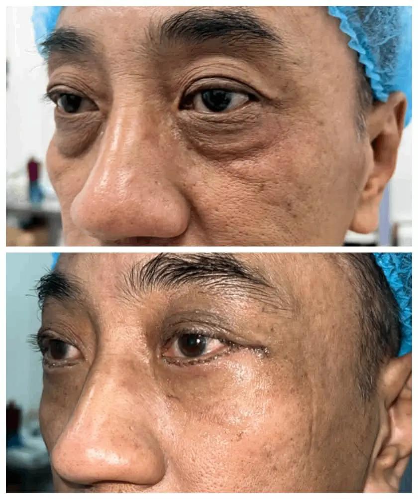 Before - after 4