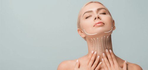 Neck Lift result 2