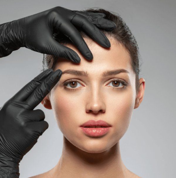 Facelift Surgery result 3