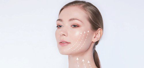 Neck Lift result 1