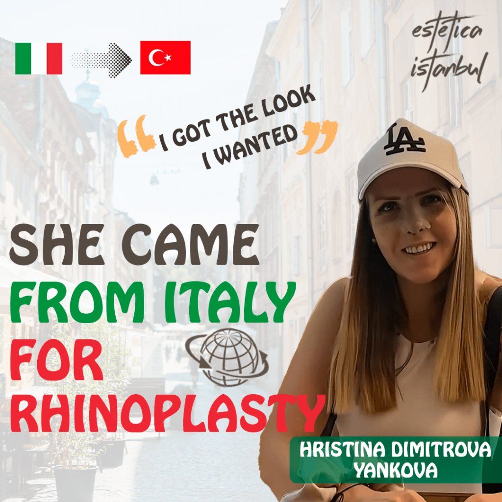 Rhinoplasty result 1