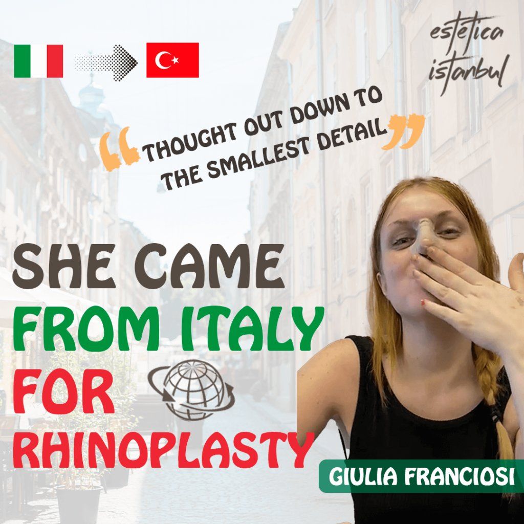 Rhinoplasty result 2