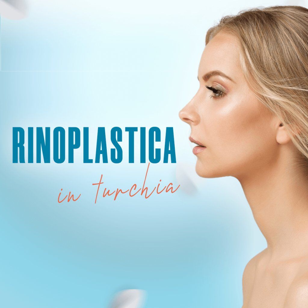 Rhinoplasty result 4