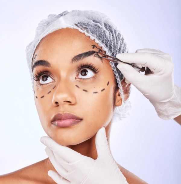 Blepharoplasty result 3