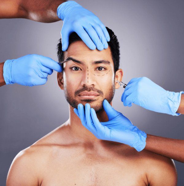 Facelift Surgery result 1