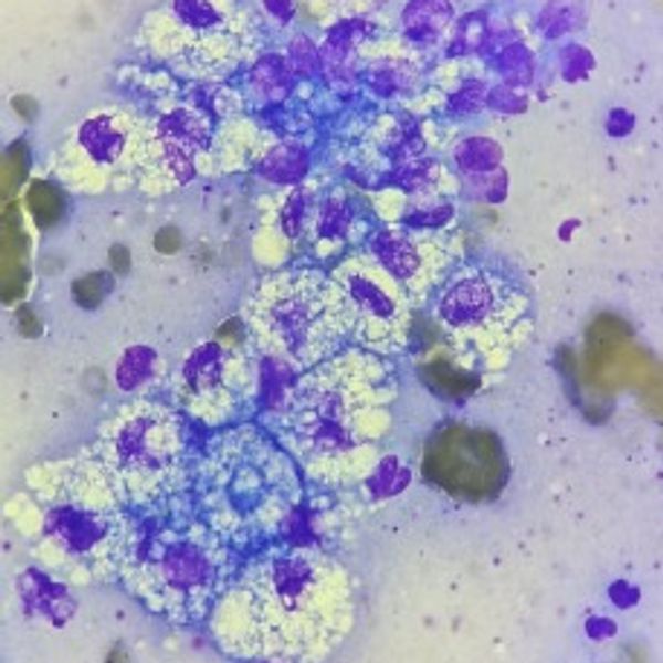 Muestra citológica - células teñidas violeta