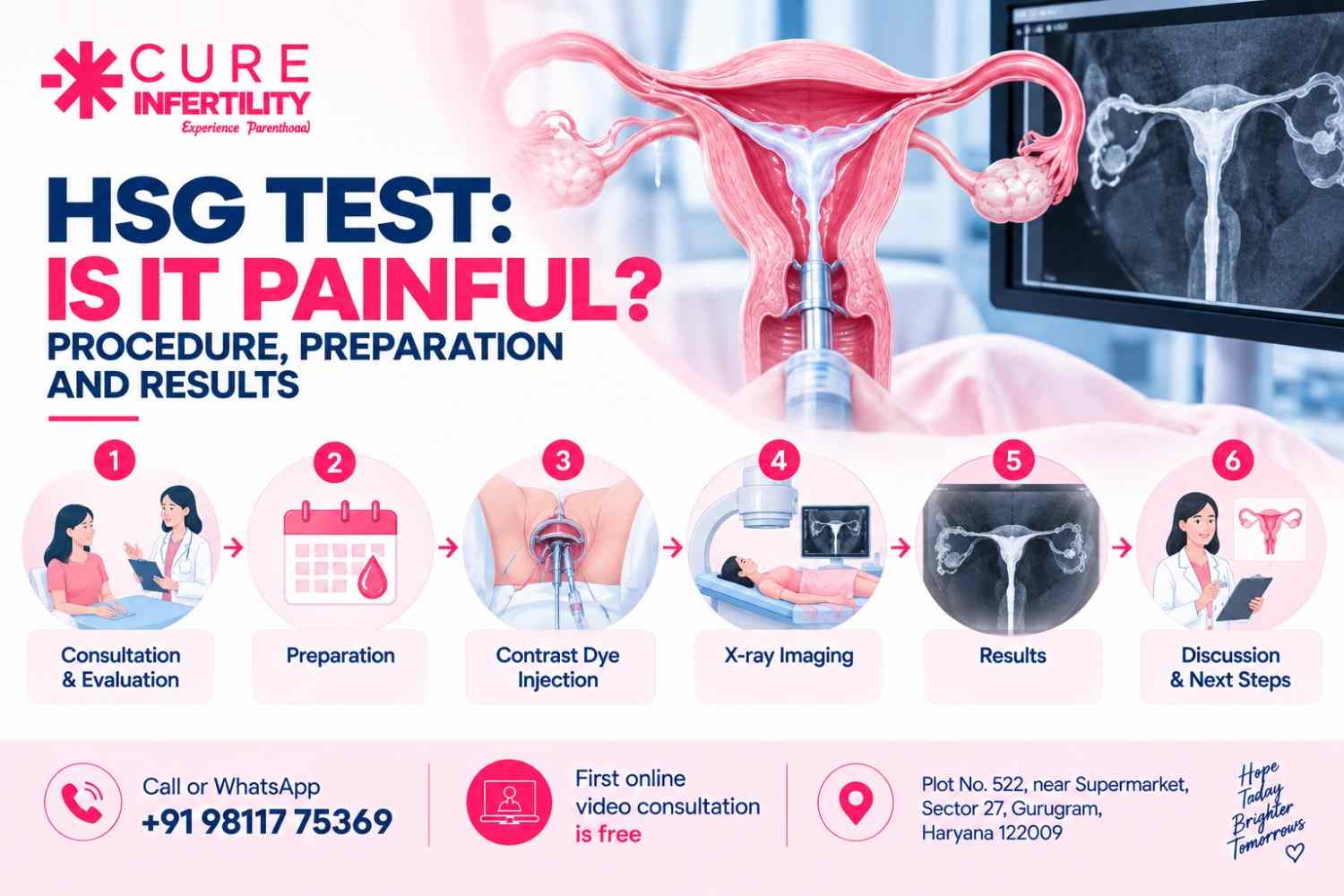 HSG Test: Is It Painful? Procedure, Preparation and Results