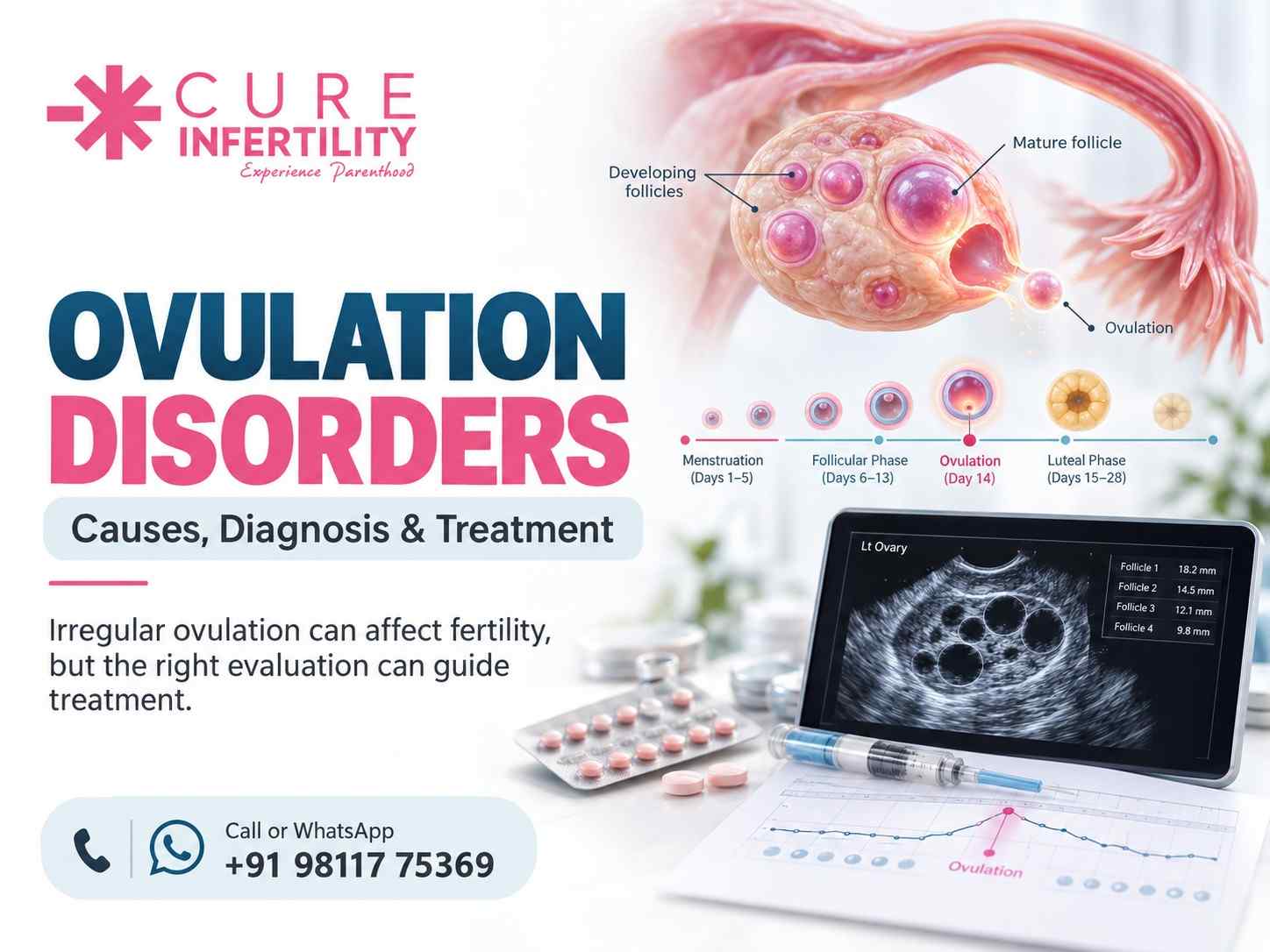 Ovulation Disorders: Causes, Diagnosis & Treatment