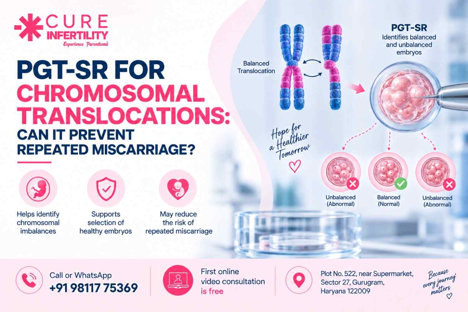 PGT-SR for Chromosomal Translocations: Can It Prevent Repeated Miscarriage?