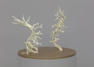 Marguerite Humeau, Dilata (II) The frustration to be stuck into one body, Dilata grows all the lives that you could have had. Inspired by the plant Mimosa Hostilis that triggers hallucinations and schizophrenia., 2022.