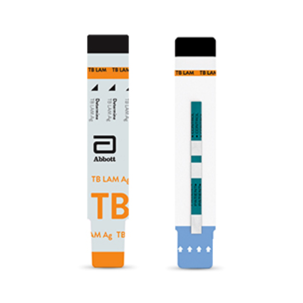 Determine TB LAM Ag