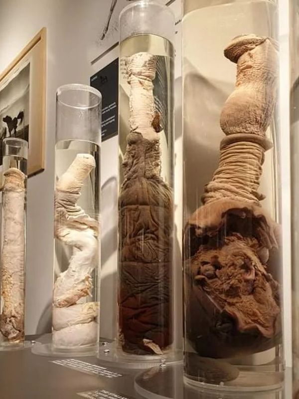 Different types of penises in jars, Phallological museum in Iceland
