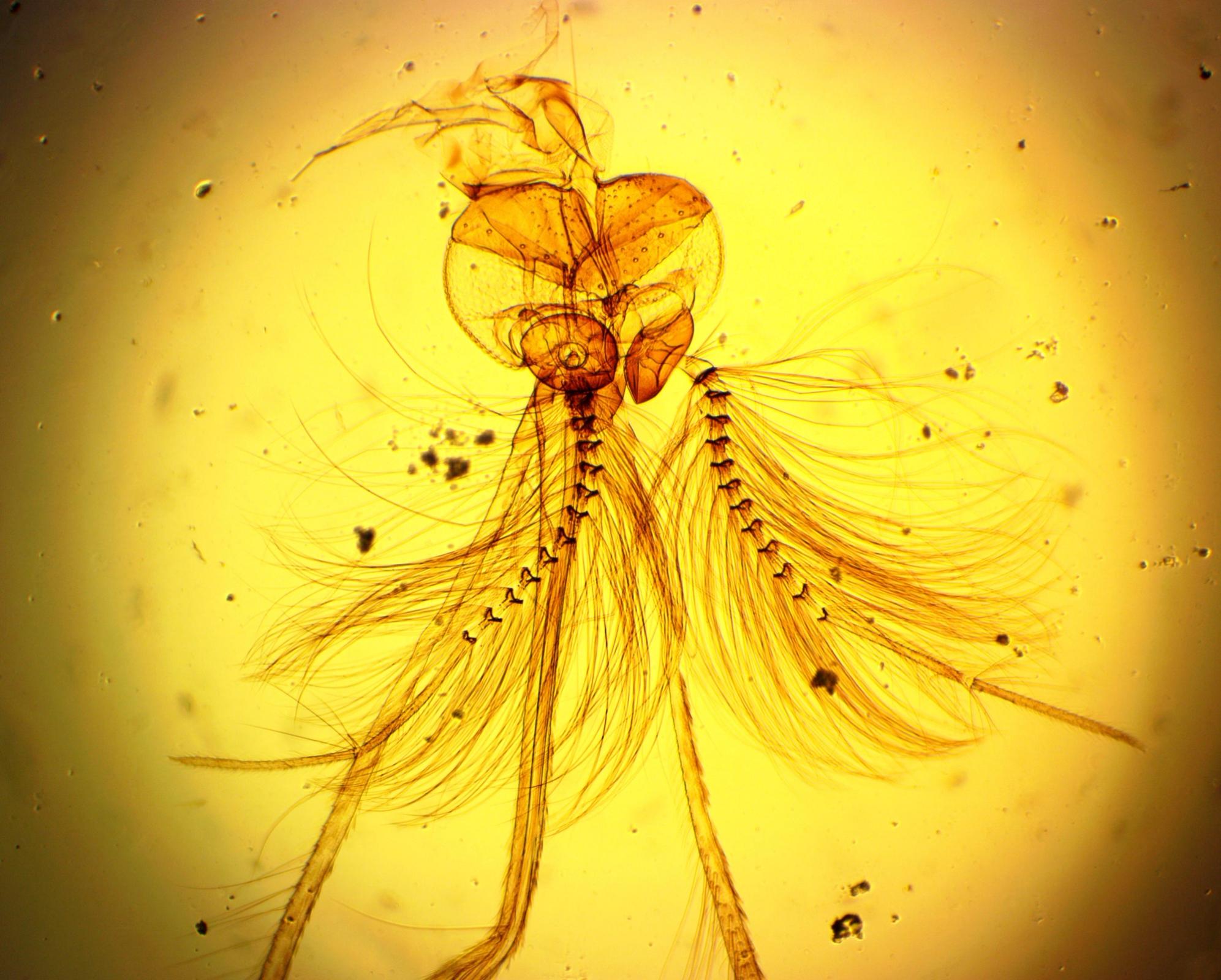 a close up of a mosquito under a microscope .