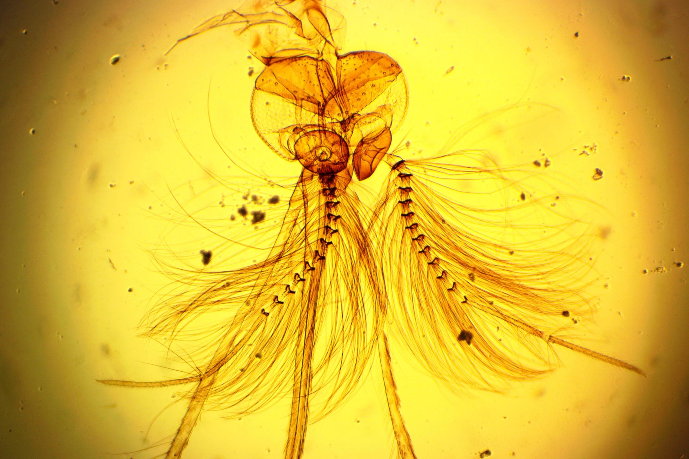 a close up of a mosquito under a microscope .