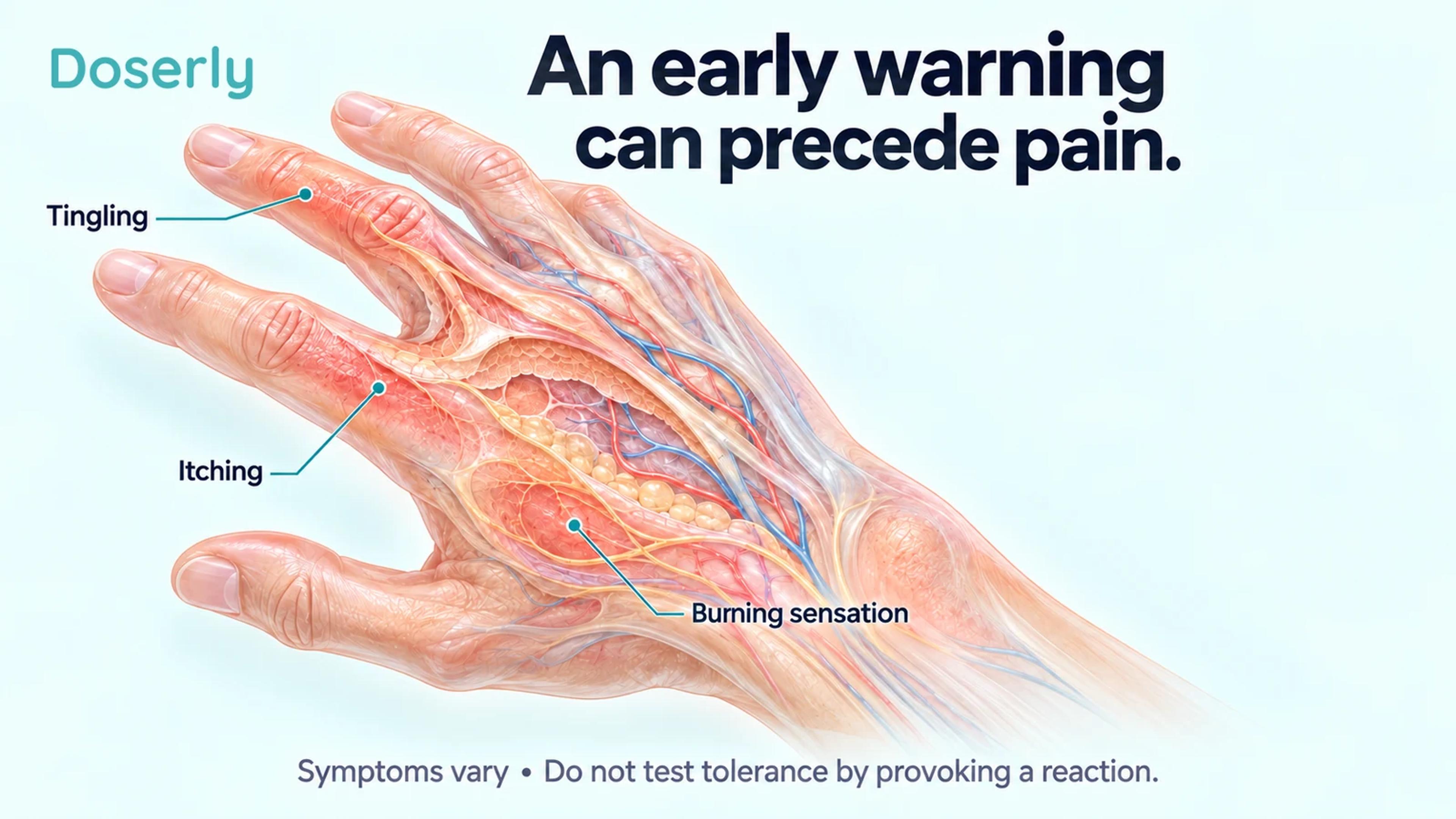 Detailed hand and skin illustration identifying tingling, itching and burning as possible early warning sensations.