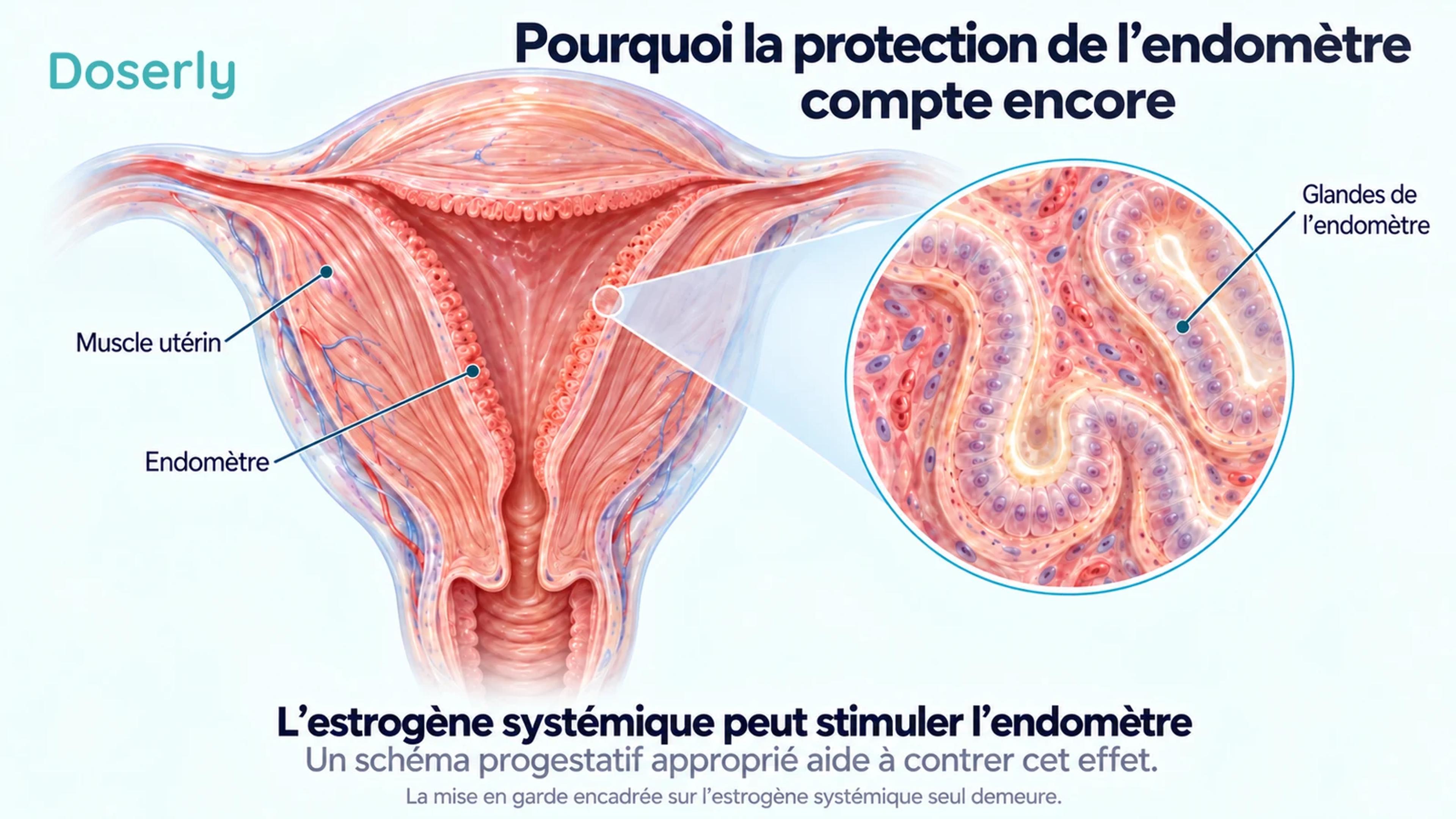 Coupe isolée de l’utérus avec une vue agrandie des glandes de l’endomètre et des légendes distinguant le muscle utérin de sa muqueuse.