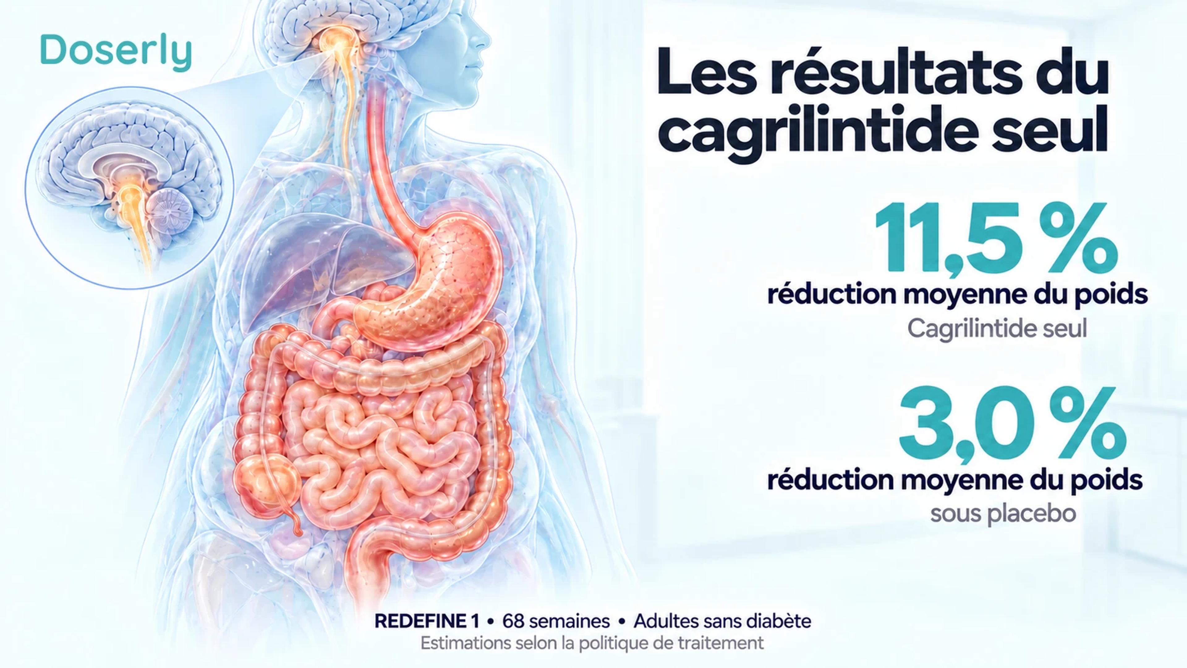 Réductions du poids sous cagrilintide seul et sous placebo dans REDEFINE 1, à côté d’une anatomie translucide