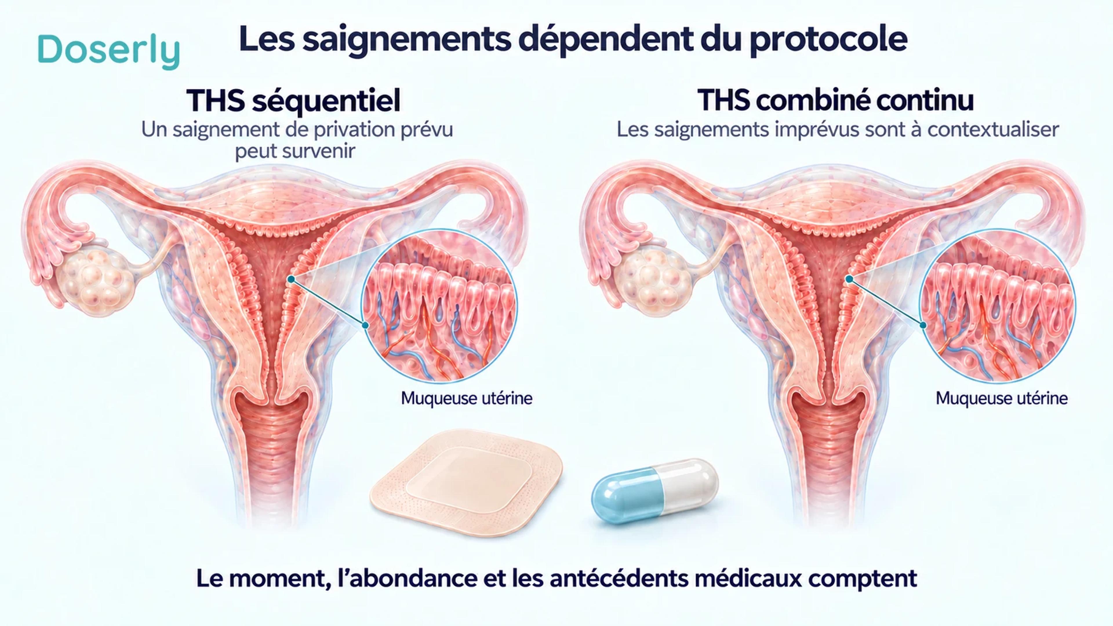Deux illustrations détaillées de l’utérus représentant le THS séquentiel et le THS combiné continu, avec la muqueuse utérine identifiée dans chacune.