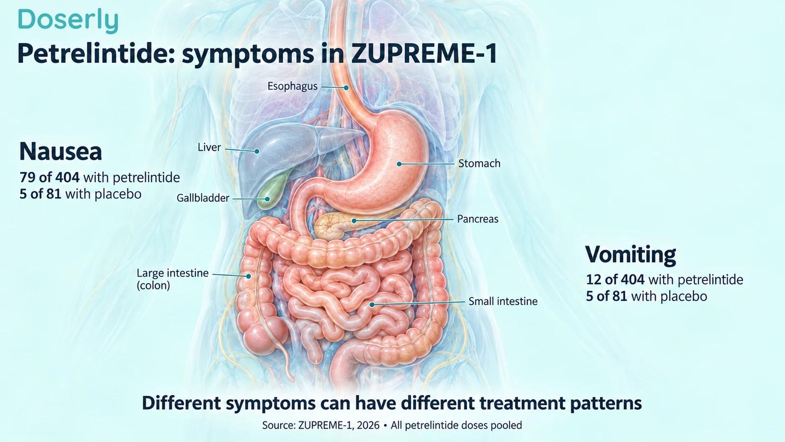 Digestive anatomy beside ZUPREME-1 participant counts for nausea and vomiting with petrelintide and placebo.
