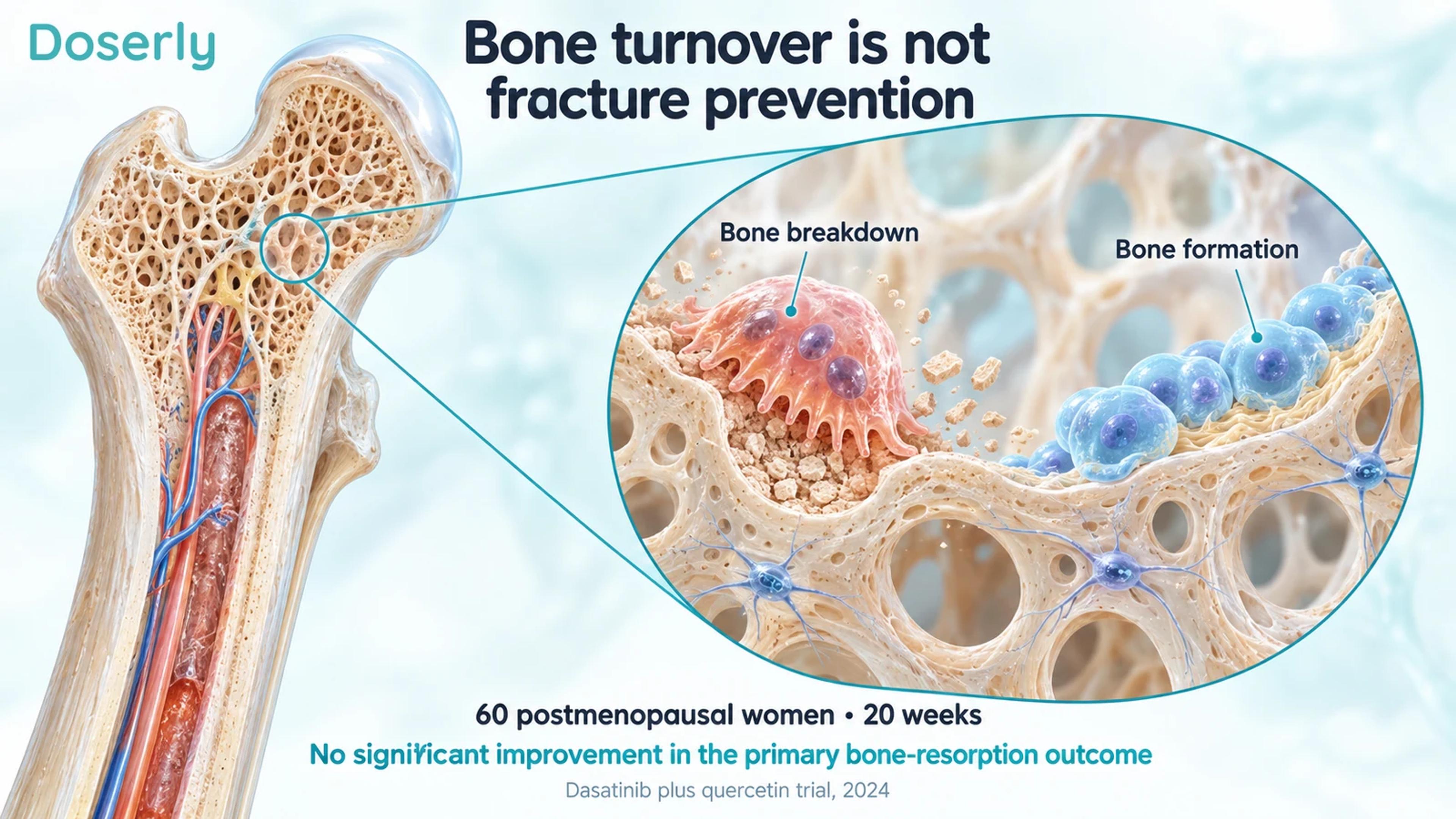 A long-bone cutaway with magnified bone-resorbing and bone-forming cells, alongside the main trial result.
