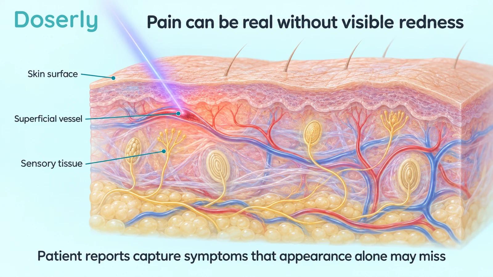Detailed skin cutaway with superficial vessels and sensory tissue beneath an ordinary-looking surface.