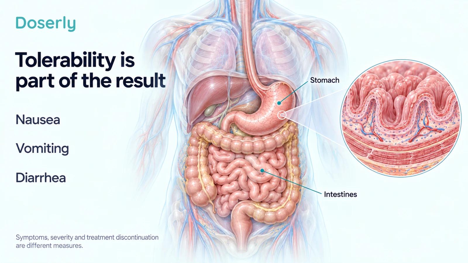 Detailed digestive anatomy with stomach and intestinal labels and the symptom terms nausea, vomiting and diarrhea, explaining the difference between symptoms and treatment discontinuation.
