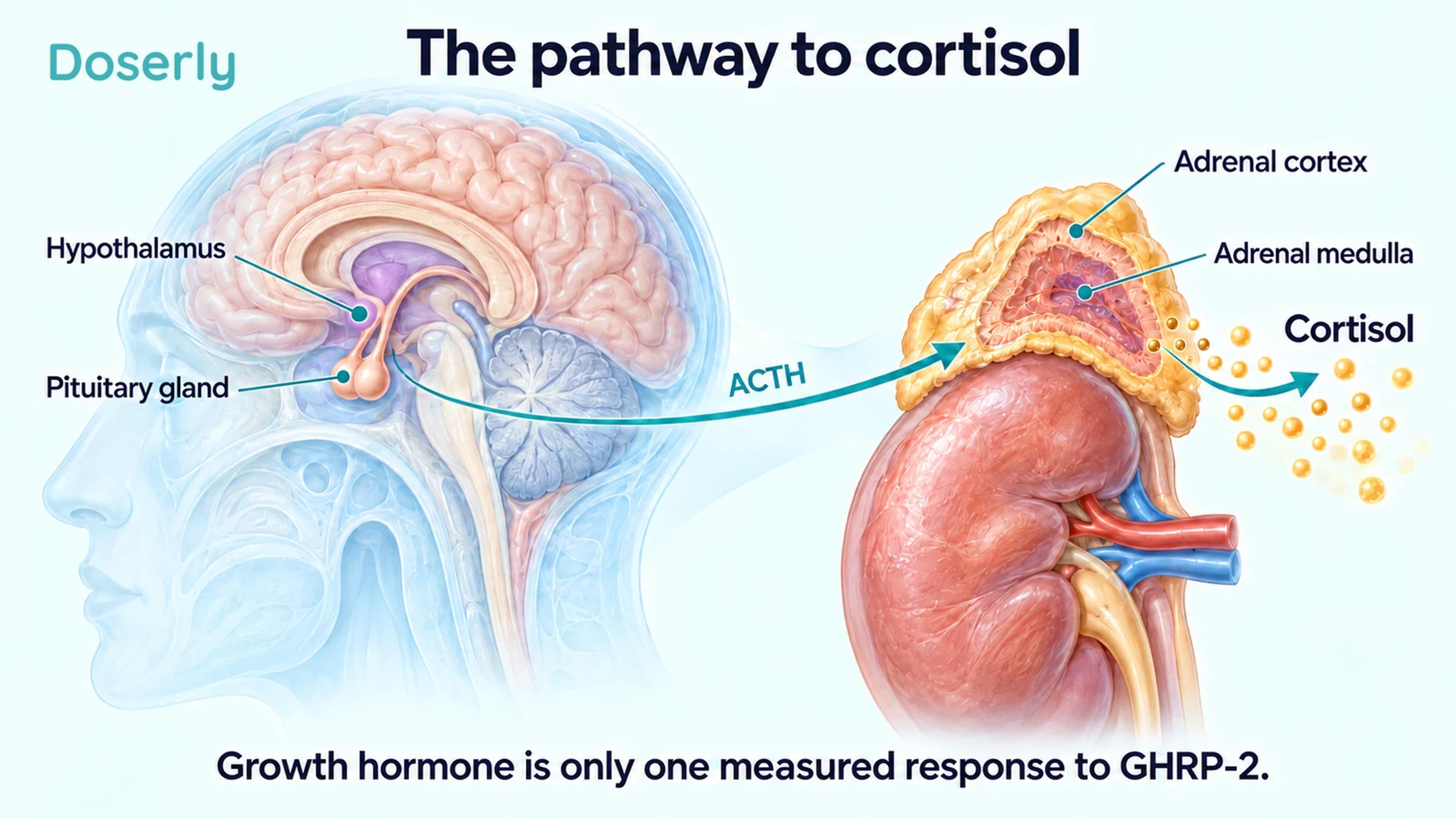Brain, pituitary and adrenal anatomy illustrate the pathway involved in cortisol secretion.