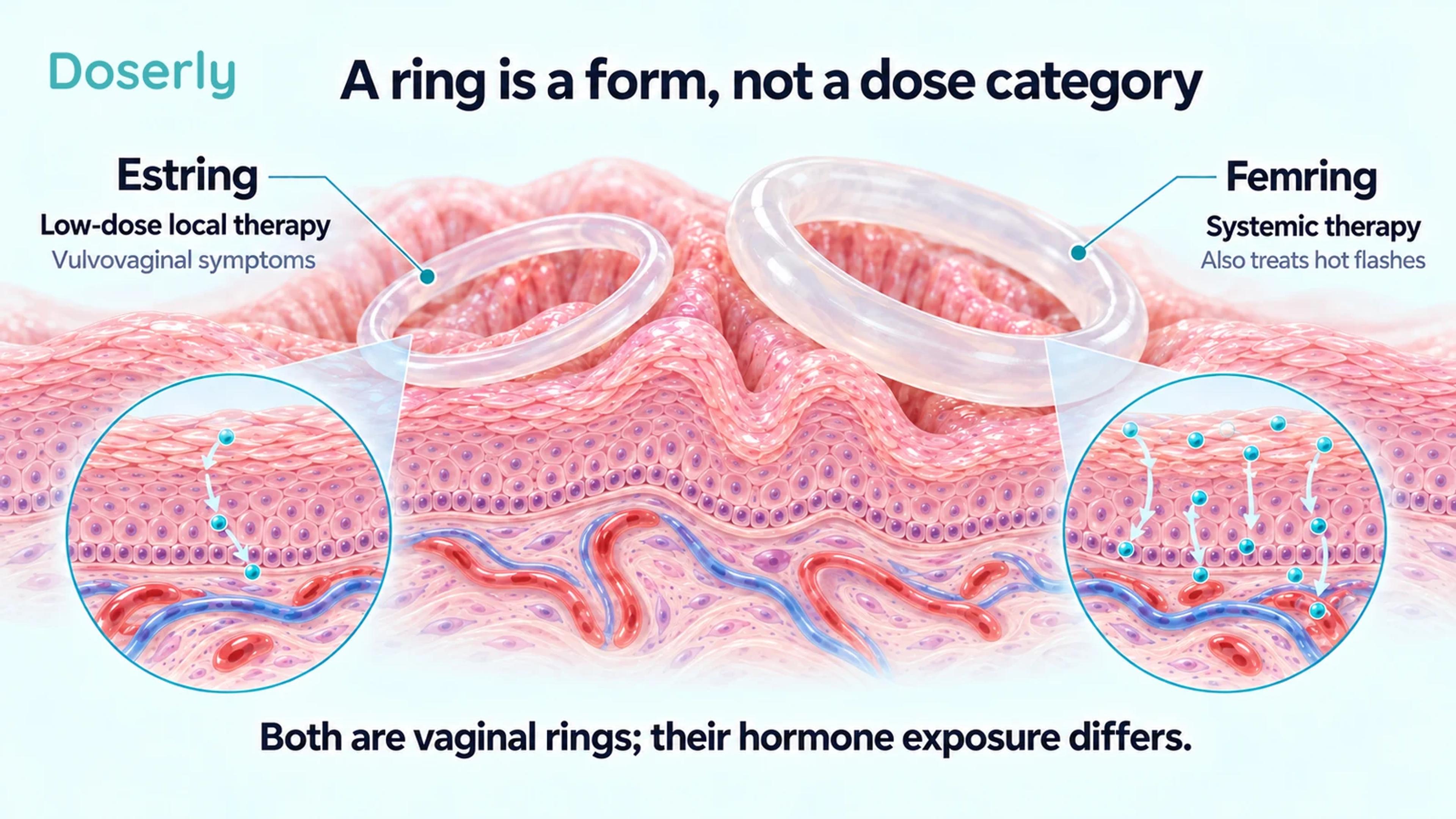 Estring and Femring medication rings illustrated with tissue insets showing their different local and systemic treatment roles.