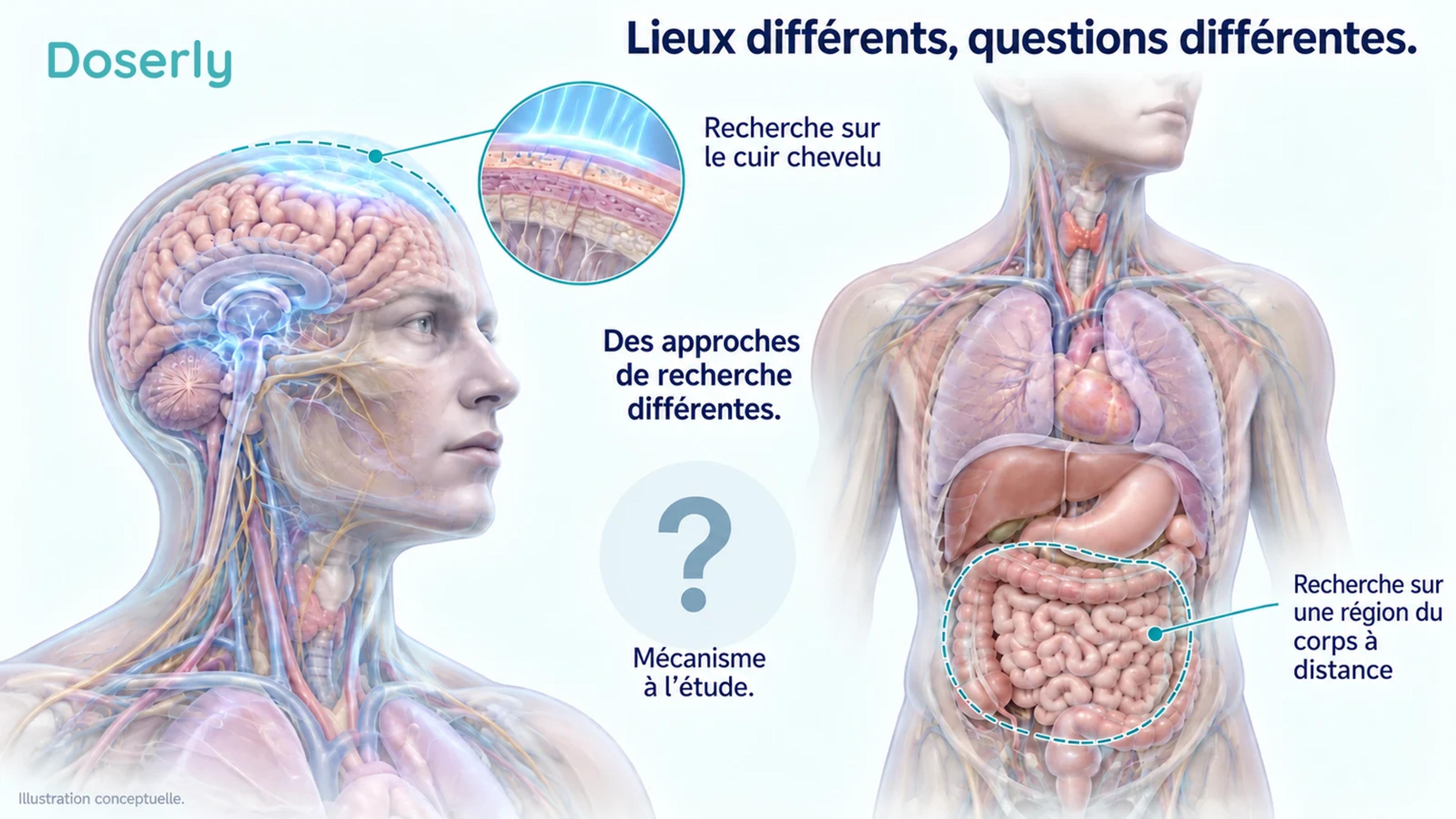Illustrations conceptuelles d’approches de recherche visant le cuir chevelu et des régions du corps à distance, séparées par un point d’interrogation et sans consignes d’exposition.