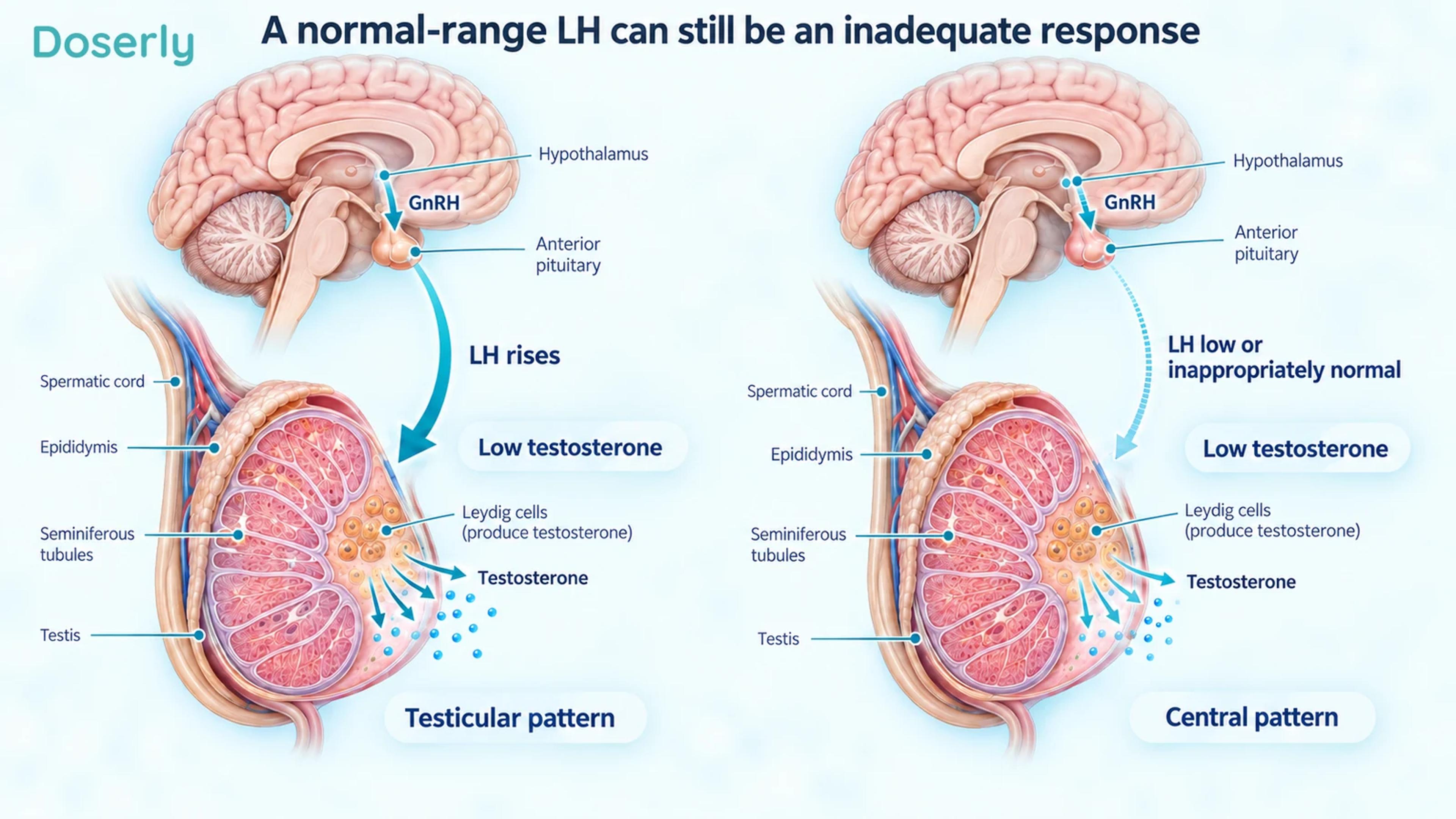 Two detailed brain-to-testis illustrations compare a rising LH response with low or inappropriately normal LH when testosterone is low.