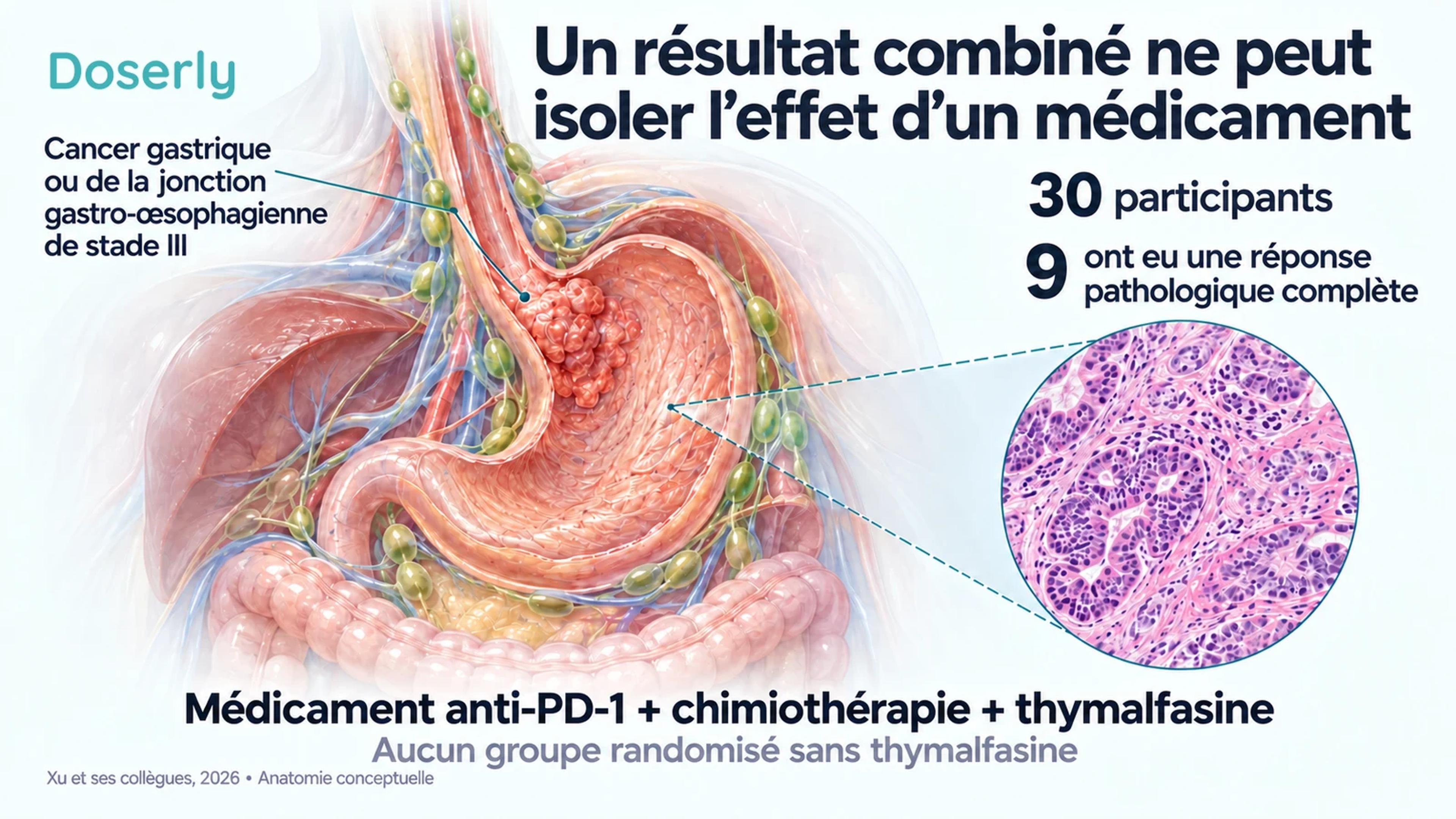 L’anatomie de l’estomac et des ganglions lymphatiques voisins, avec un encadré conceptuel d’anatomopathologie, illustre l’étude du traitement combiné chez 30 personnes.
