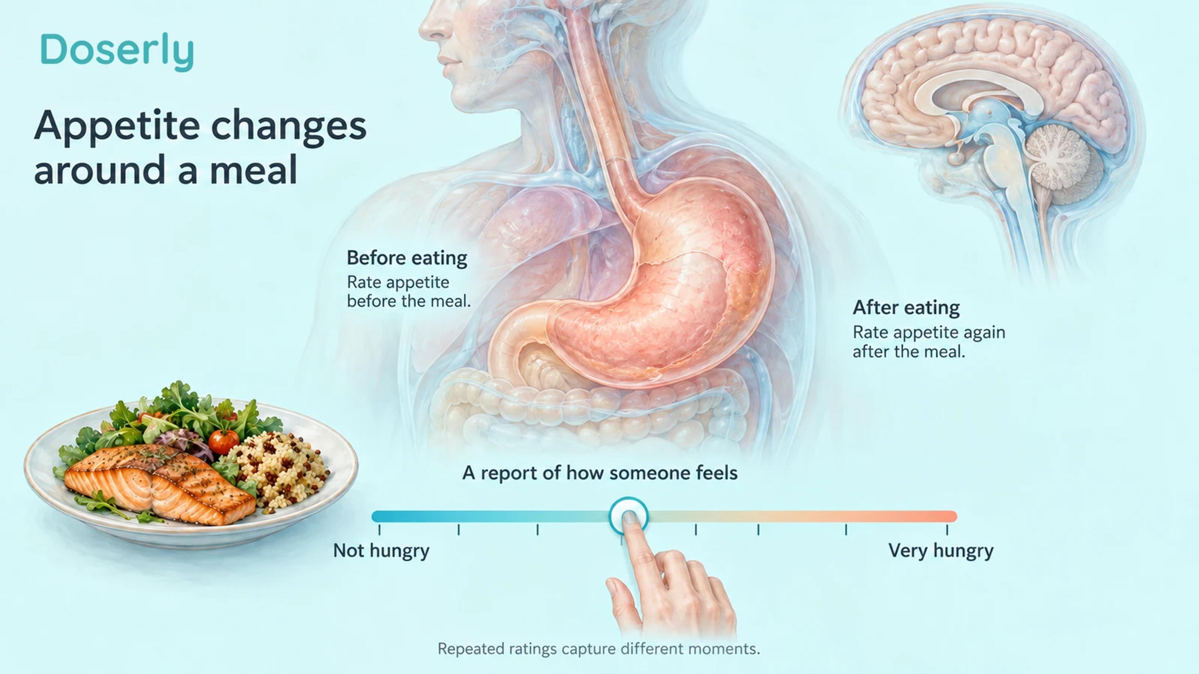 Stomach anatomy and a conceptual hunger-rating scale illustrate repeated appetite reports.